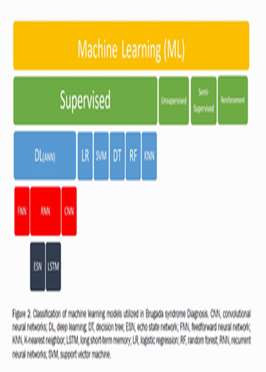 Artificial intelligence for Brugada syndrome diagnosis and gene variants interpretation