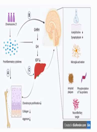 Association of neurodegeneration, cognitive impairment, and short stature in Down syndrome; Could proinflammatory cytokines be t